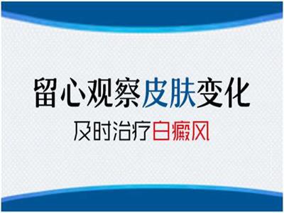 预防护理-如何有效地预防白癜风呢-